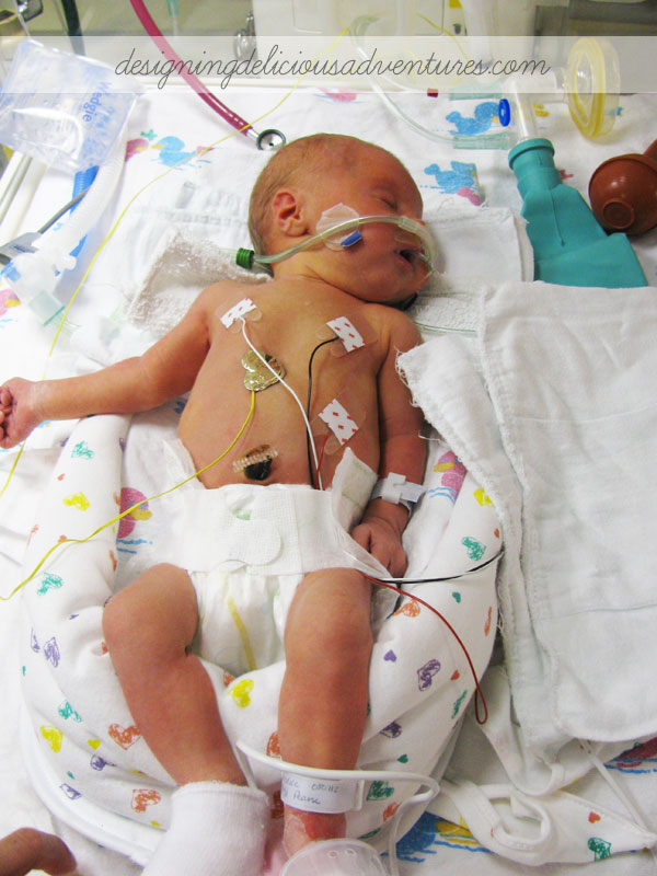 Caring for a Preemie